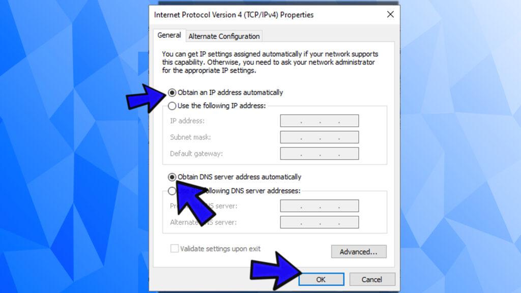 obtain ip address and dns server automatically